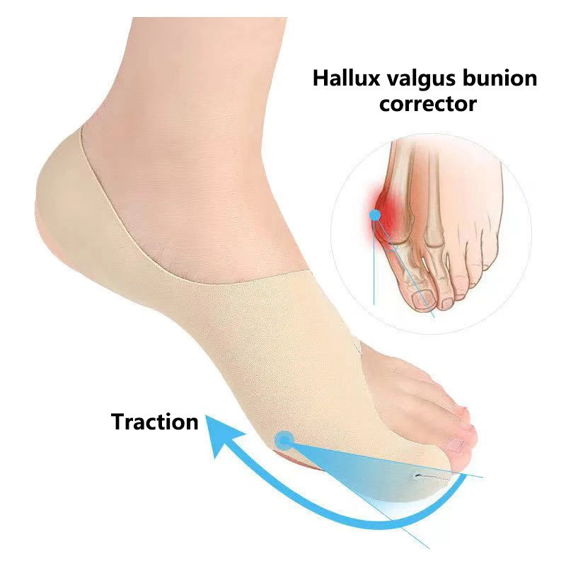 1 pár big špičkových chráničov upravte ponožky unisex mäkkých pedikúrov pre halónie Hallux Valgus Orthopedic obväz.