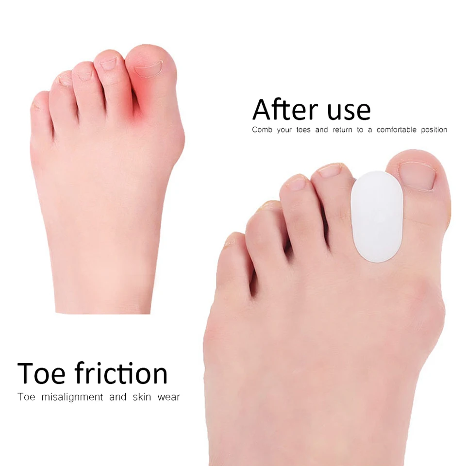 1 pár kladiva Toe Poricent Gel Gel Bunon Corrector Toe Nosidrovanie pre prekrývajúce sa prsty na nohách mužov