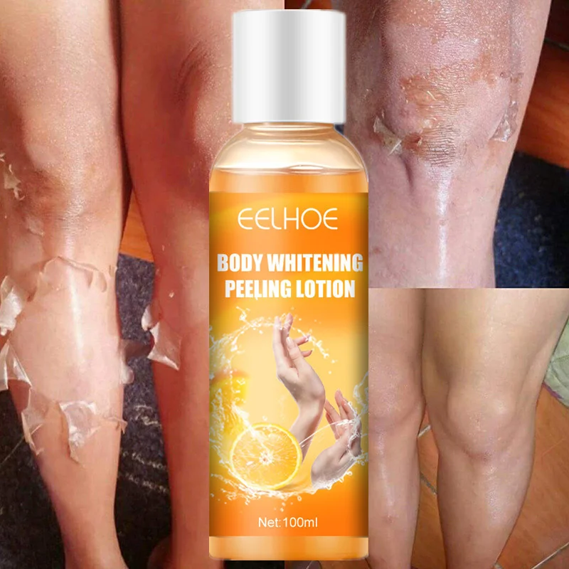 100 ml pomarančová kôra odlupujúca gél Zvlhčovanie Znižovanie zmiznutia melanínovej esencie starostlivosť o pleť na pleťové pleťové lotion Gel