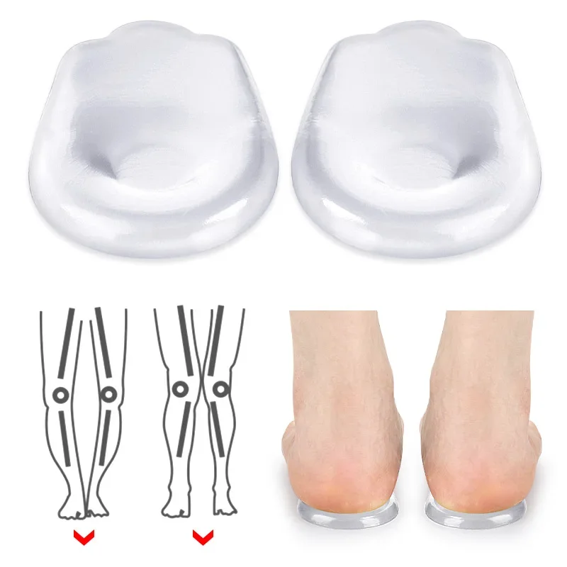 1Pair Xo Noha Silikón Tvar korekcie Zložka Zložka Zastúpi