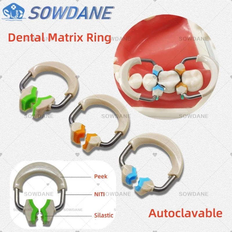 1PC Dentálna maticová súprava sada kontúrovaných matičiek NITI PEEK Ring Matrix Band Wedge Plastic Kit