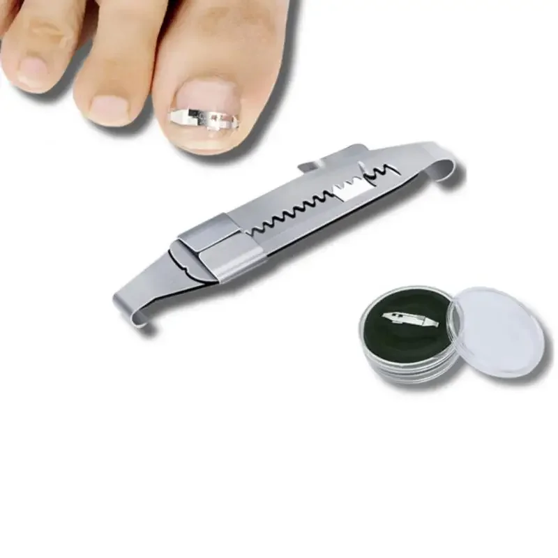 1pcs zarastenie korekcie na nohách korekcia na nohách Profesionálne špičky na nechty na nechty Pedikúru manikúru Clipper Fixer