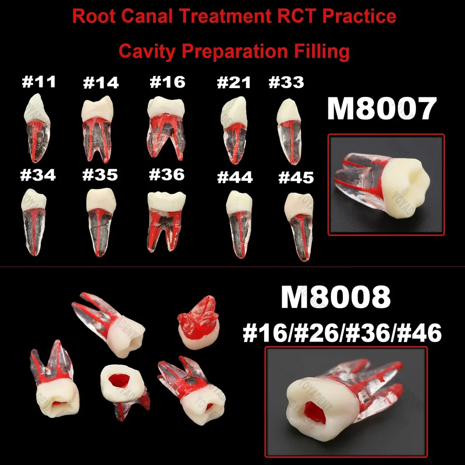 5pcs/10ks zubný endo Endo koreňový kanálika Štúdia RCT Practice Model pre prípravu dutiny Výučba zubných zubov Model výučby zubov