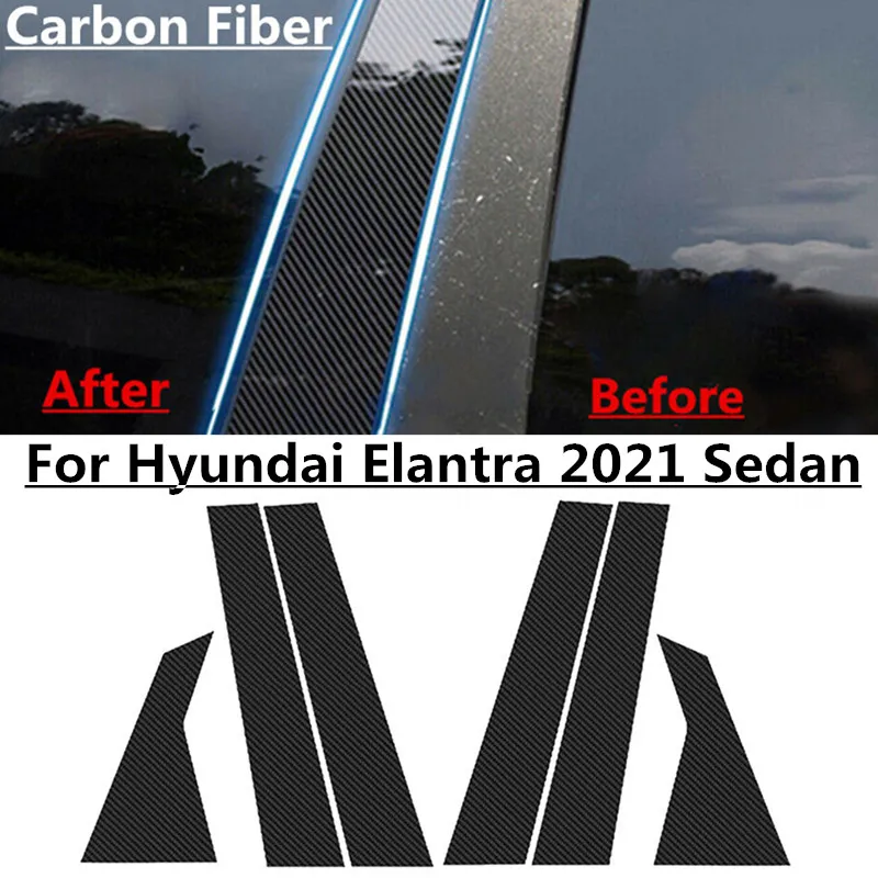 6ks/sada uhlíkových vlákien Kryt stĺpika stĺpika na stĺpik Dvere pre Sedan Hyundai Elantra 2021