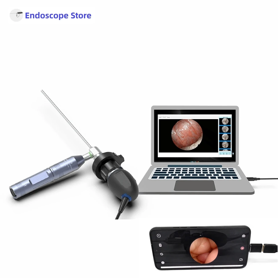 HD 1080p 60fps prenosný endoskop USB Type-C Camera ENT veterinárna nemocnica Mobilný telefón Displej