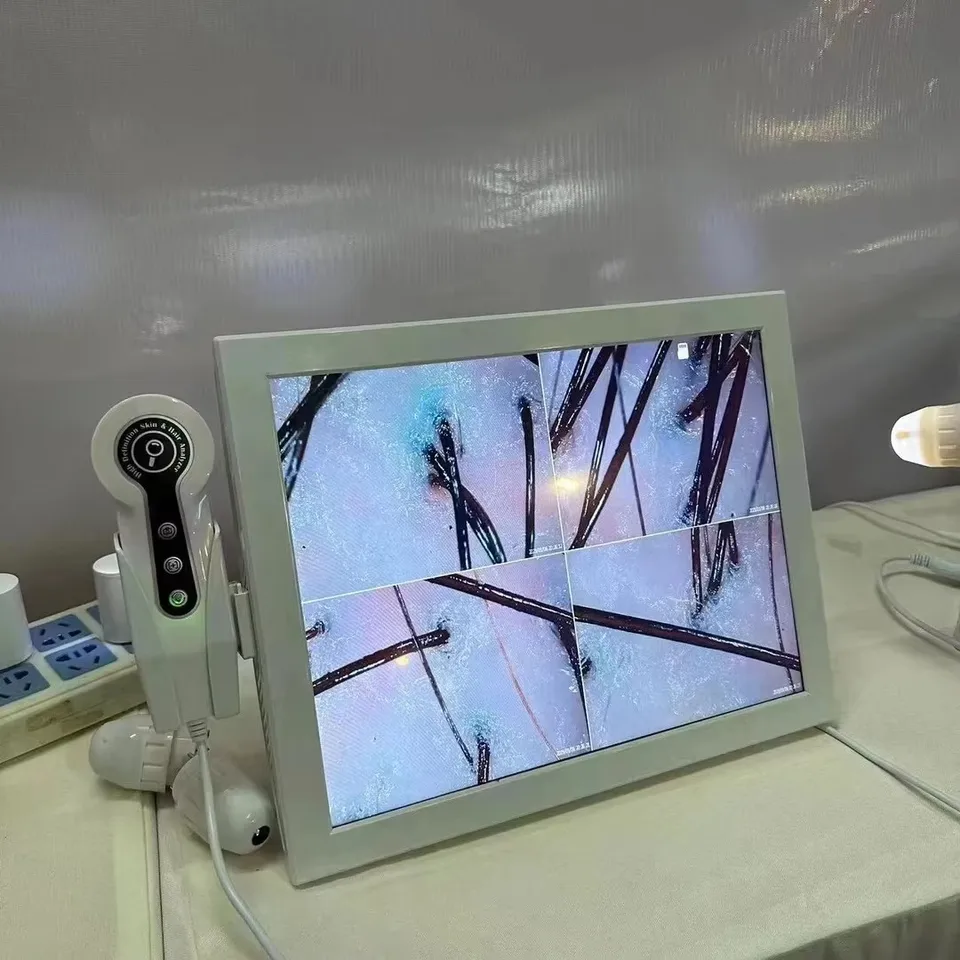 HD Digital Skin Analyzer Profesionálny detektor vlasovej pokožky vlasovej hlavy Hair folikul Oil Test Zariadenie vlhkosti 15 palcov 2023