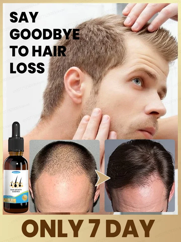 Huile Essentielle de Croissance Rapide des Cheveux, Répare La Calvitie