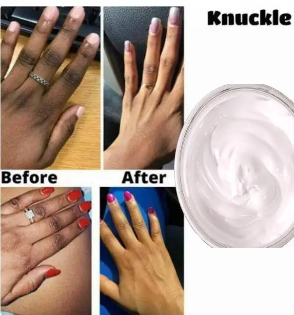 Knuckle Cleanser, sérum. Čistič z tmavého lakťa. Sérum z tmavej ruky. Temné nohy sérum.Dark prsty na nohách sérum. čistiaci prostriedok