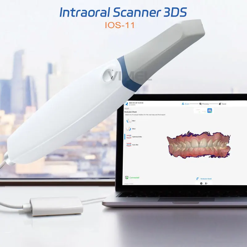 Originálny zubný intraorálny skener 3DS ISO-11digital Impression Intra perorálny 3D skener Runyes