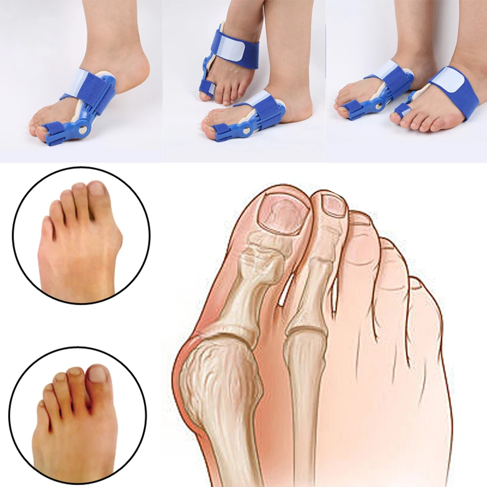 Ortotika veľké prsty korektor Hallux Valgus nohy na úľavu od bolesti nohy strážca kosť Kost Noc bunon nočné dni dlaň