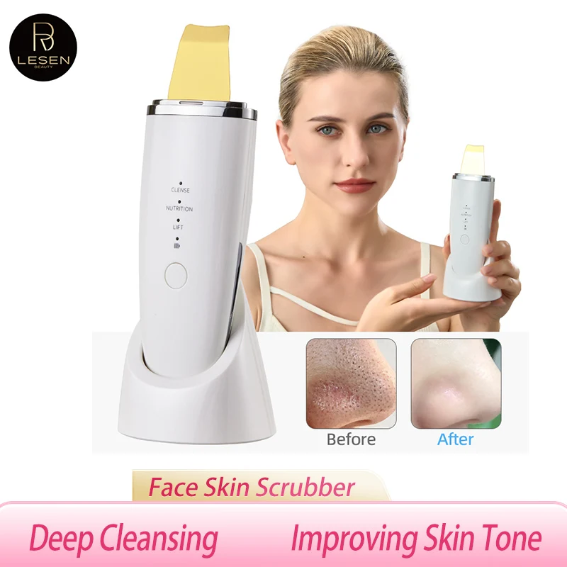Ultrazvukové kožné čistenie čiernej hlavy Čistiaca lopatka na čistých čistých čistiacich škrabka masáž Masáž zdvíhač na starostlivosť o pleť v náradia