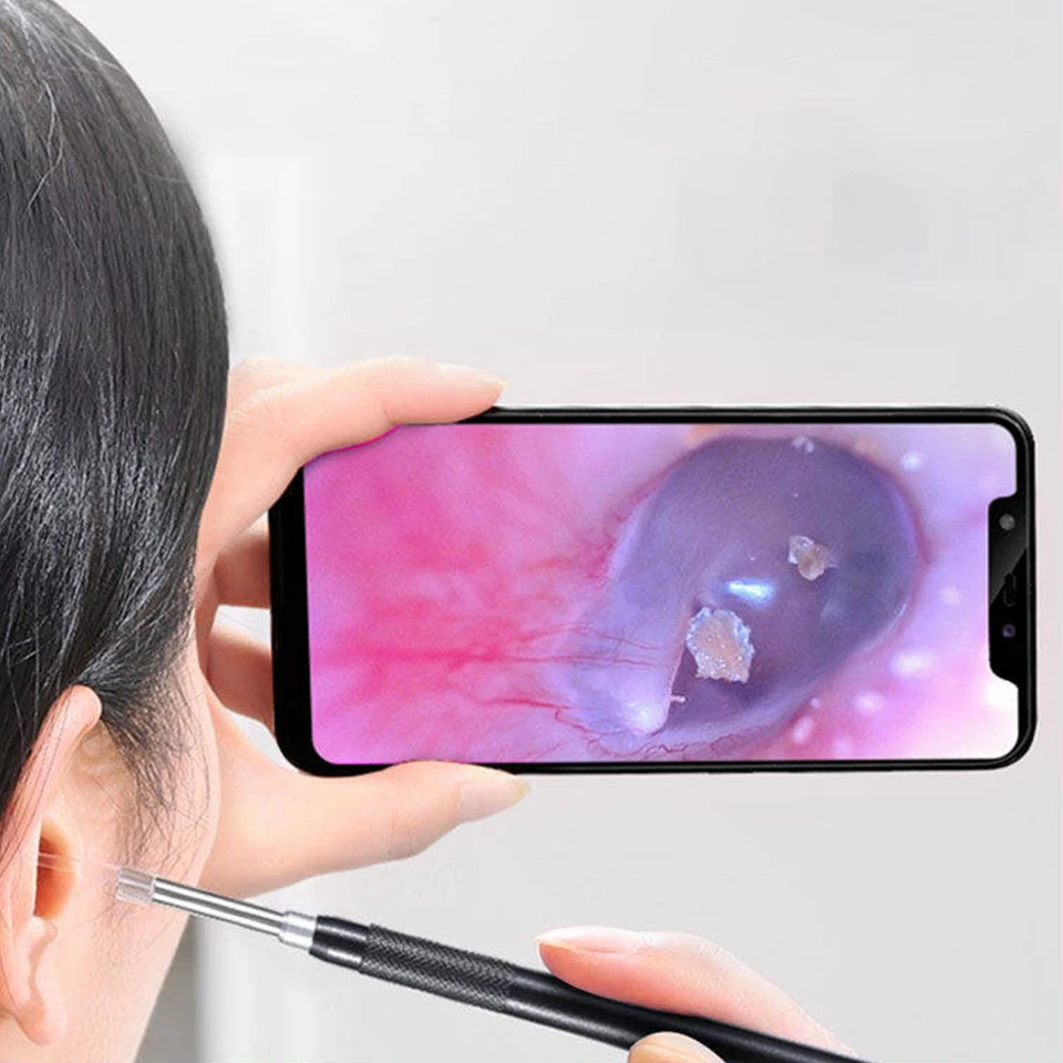 USB endoskop fotoaparát vizuálna inšpekcia ucha Espect Espect Boreskop Flexibilná kamera 5 mm pre Xiaomi Huawei telefón s Androidom Harmony Používajte DIY