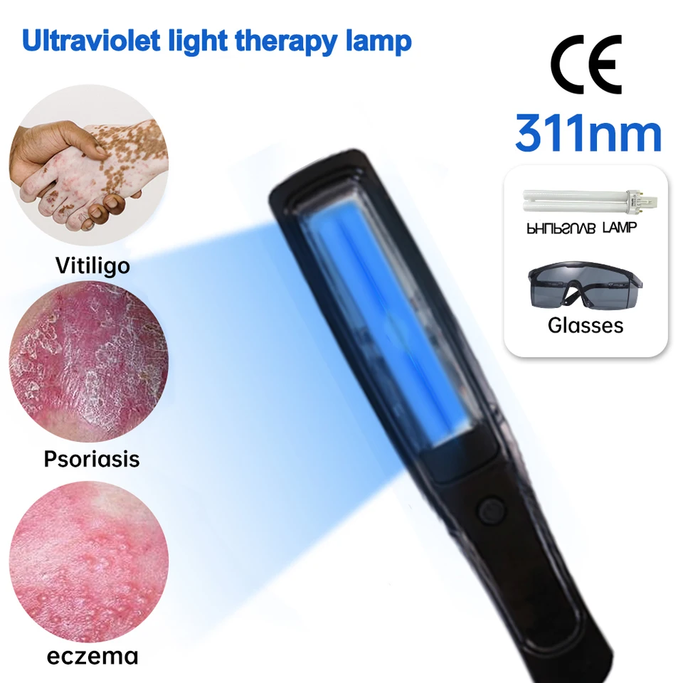 UVB lampa pre terapiu psoriázová lampa na ošetrenie pokožky Light 308nm úzkobandí ultrafialová vitiligo fototerapia prístroj
