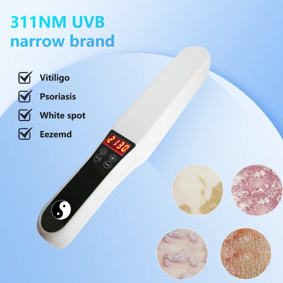 UVB Vitiligo Liečba zariadenia Fyzická terapia Ultrafialové svetlo lekárske svetlo zdroj