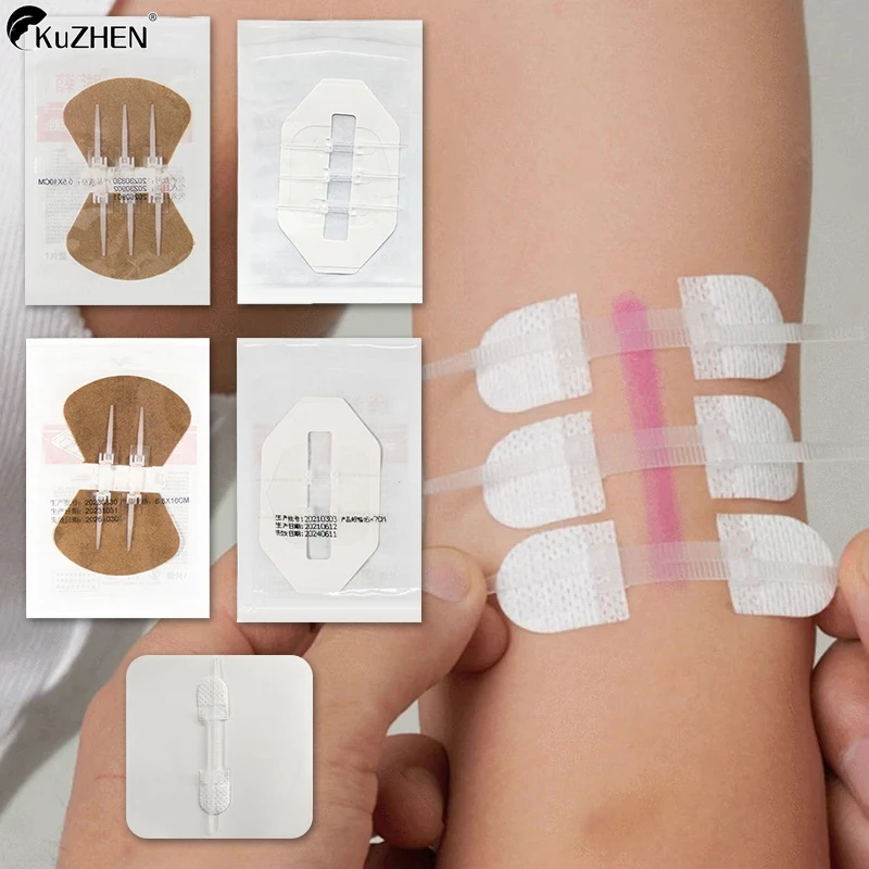 Uzatváranie pohotovostných rany Zip Stitch Stitus Bandaids Opravy rany bez stehov pre outdoorové aktivity rýchle rany zrazeniny