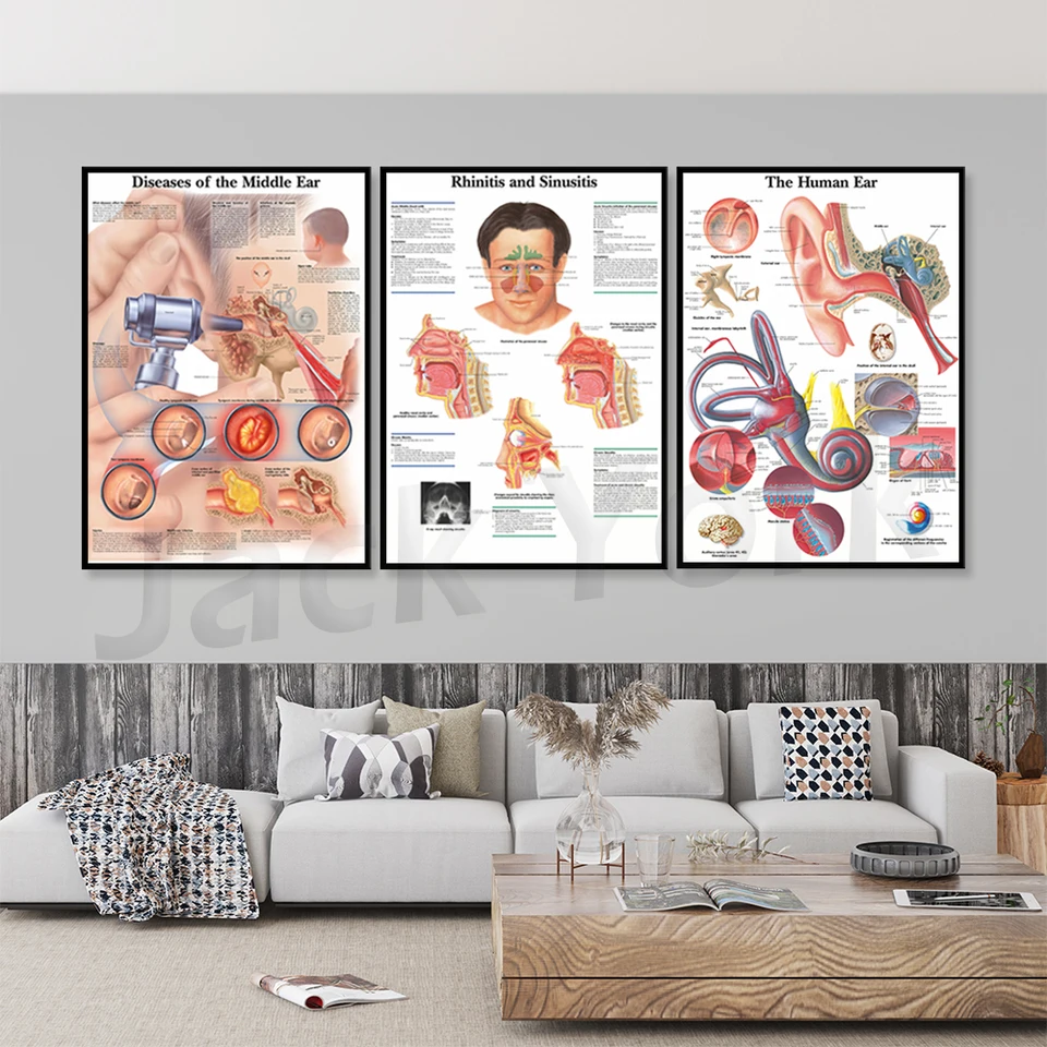 Uši, nosa a krk (ENT) Art Plagát tlač tela mapa Canvas maľba nástenné obrázky pre lekárske vzdelávanie Domovod