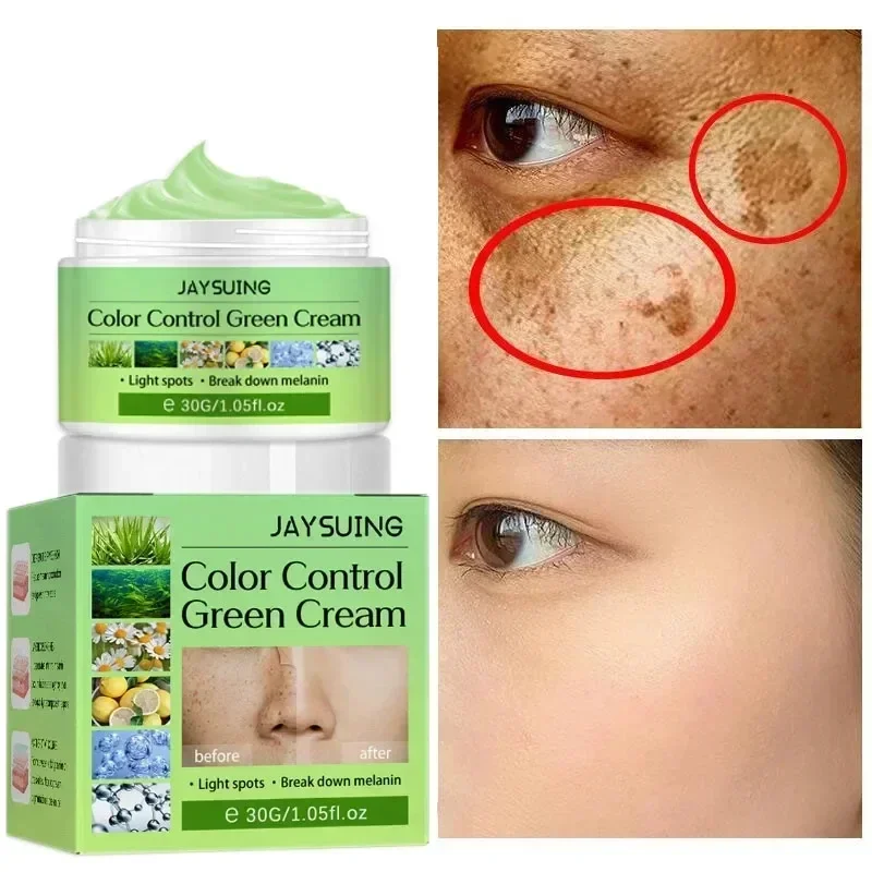 Výkonná škvrna s bielym krémom rozjasňuje pokožku Rýchlo eliminuje melanínovú pigmentáciu melasma tmavé škvrny zvlhčujú kozmetický gél