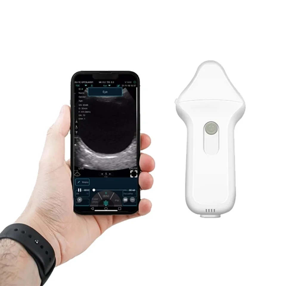 WiFi bezdrôtové farebné oftalmické ultrazvukové farby Doppler sonda podporuje iOS Android Windows