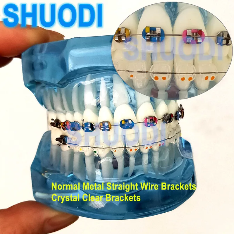 Zubné ortodontické zuby zubný model krištáľovo číry držiak a kovové konzoly pre komunikáciu pacienta zubný študijný model model
