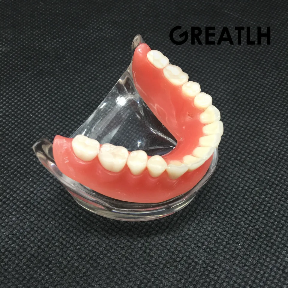 Zubné preddržanie interiéru mandibulárne spodné zuby Model mandibular s implantáciou obnovy zubné výučba Štúdia zubov