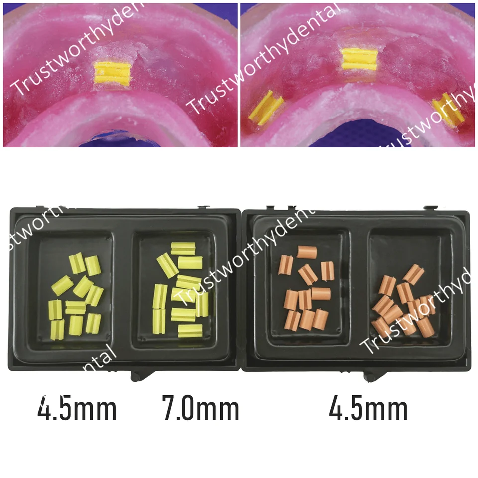 Zubné zubné protézy Hader Pripevnené pruhy Clips Retention Overdenture Rider Hader Bar krátky 4,5 mm dlhý 7 mm
