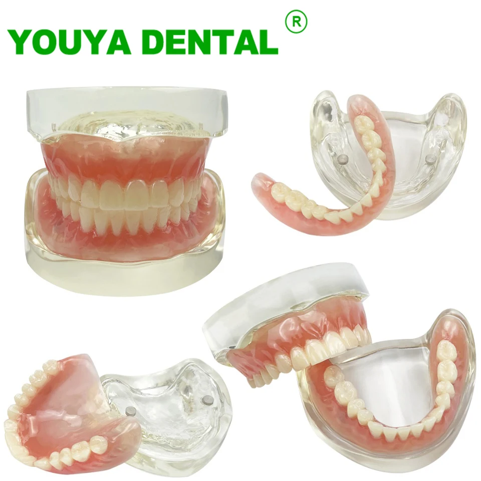 Zubný implantát Model 2 implantát Overdenture Restoration Model horných spodných zubov Typodont Dentistry Products pre výučbu štúdie